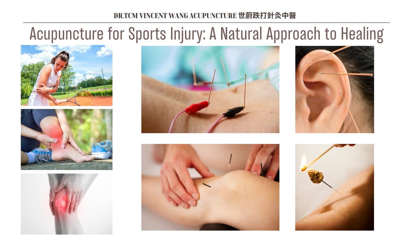 Acupuncture for Sports Injury: A Natural Approach to Healing