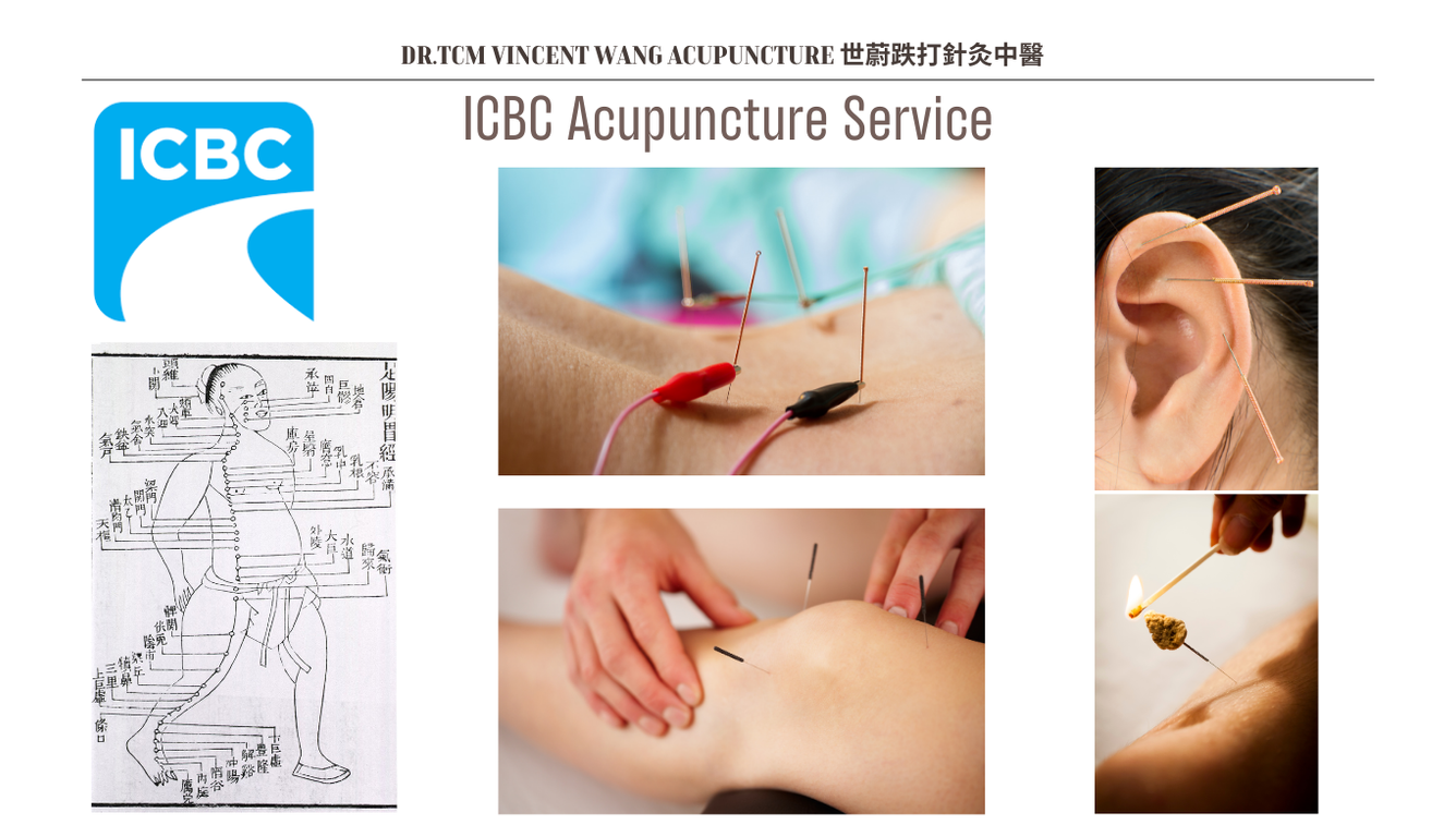 ICBC Acupuncture