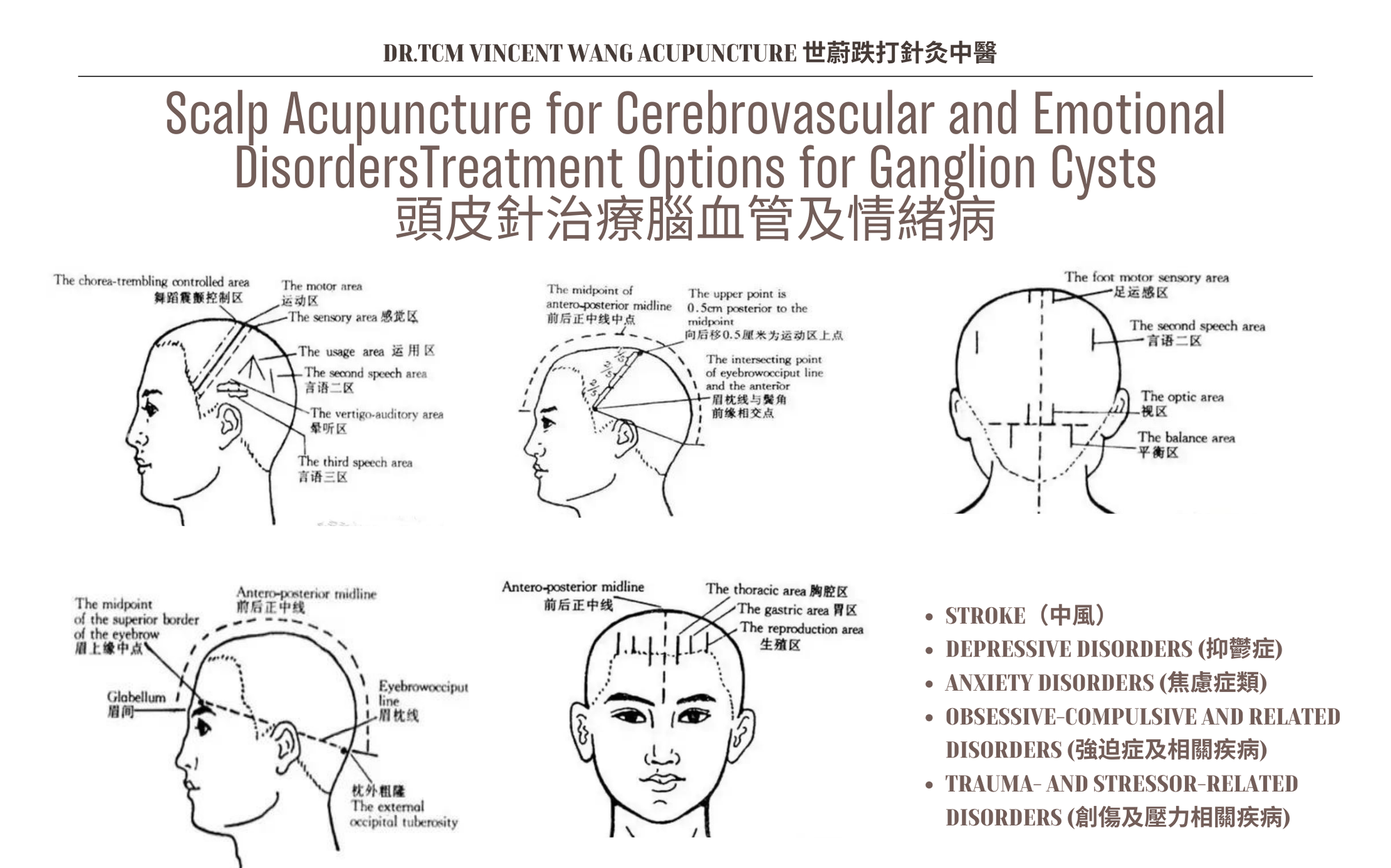 頭皮針治療各種腦血管及情緒病 Scalp Acupuncture for Cerebrovascular and Emotional Disorders